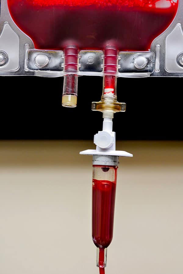 ozone-iv-blood-bag-600x900px ozone iv therapy bag